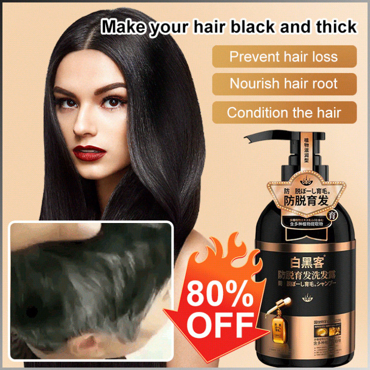 Hair Gradual Receding Of The Hairline Shampoo Conditioner Hair Care