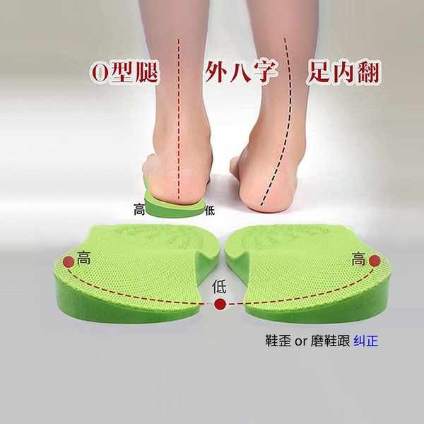 Leg Corrector O-Type Leg Correction o leg Outer Eight-Character Foot o ...