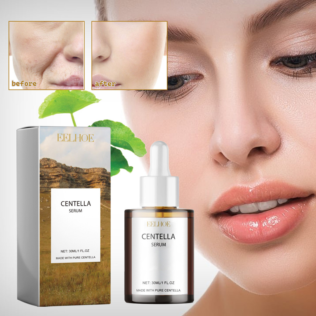 MY Stock>Centella Asiatica Essence Moisturizing Improves Dry Skin ...