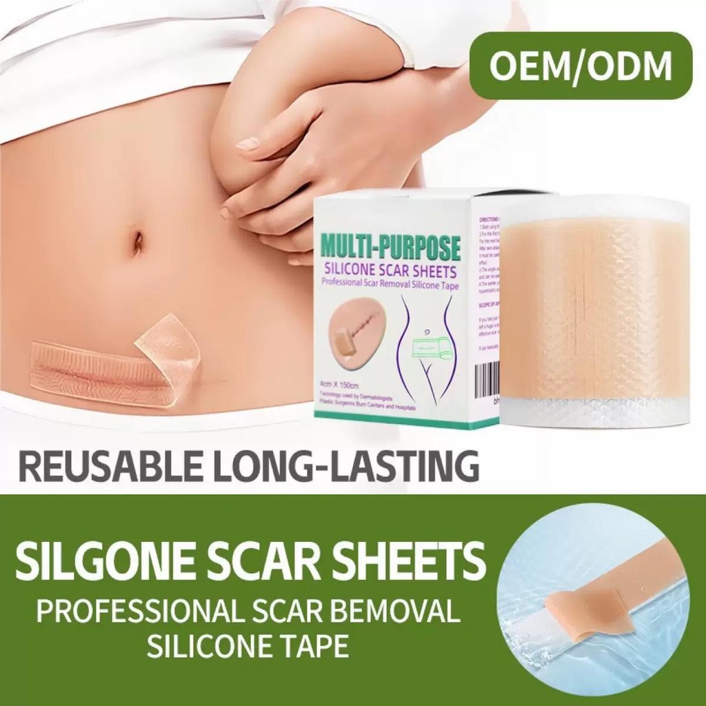 1 Roll Scar Silicone Gel Sheet Patch Tape Sticker Scar Skin Stick ...