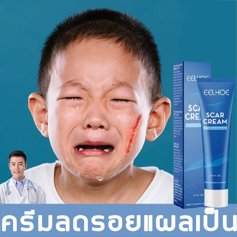 EELHOE Scar Cream Scar Reduction Cream Scar Reduction Gel Scar ...