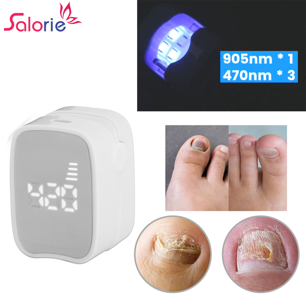 Salorie Digital Laser Nail Fungus Treatment Device Fingertip ...