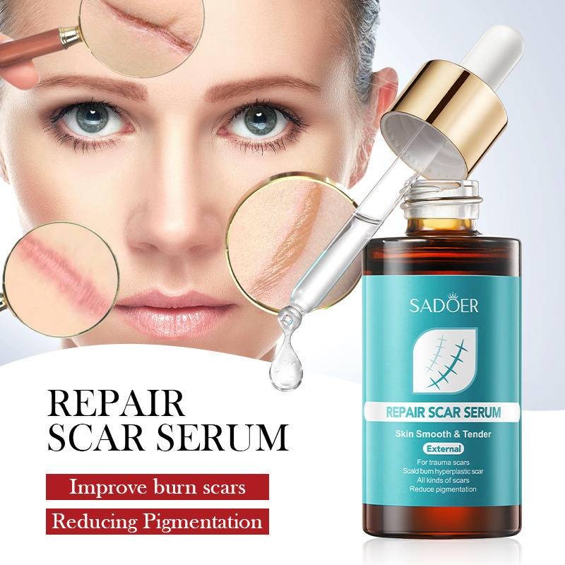 SADOER 40ml Repair Scar Serum Smooth&Tender External Removal Stretch ...