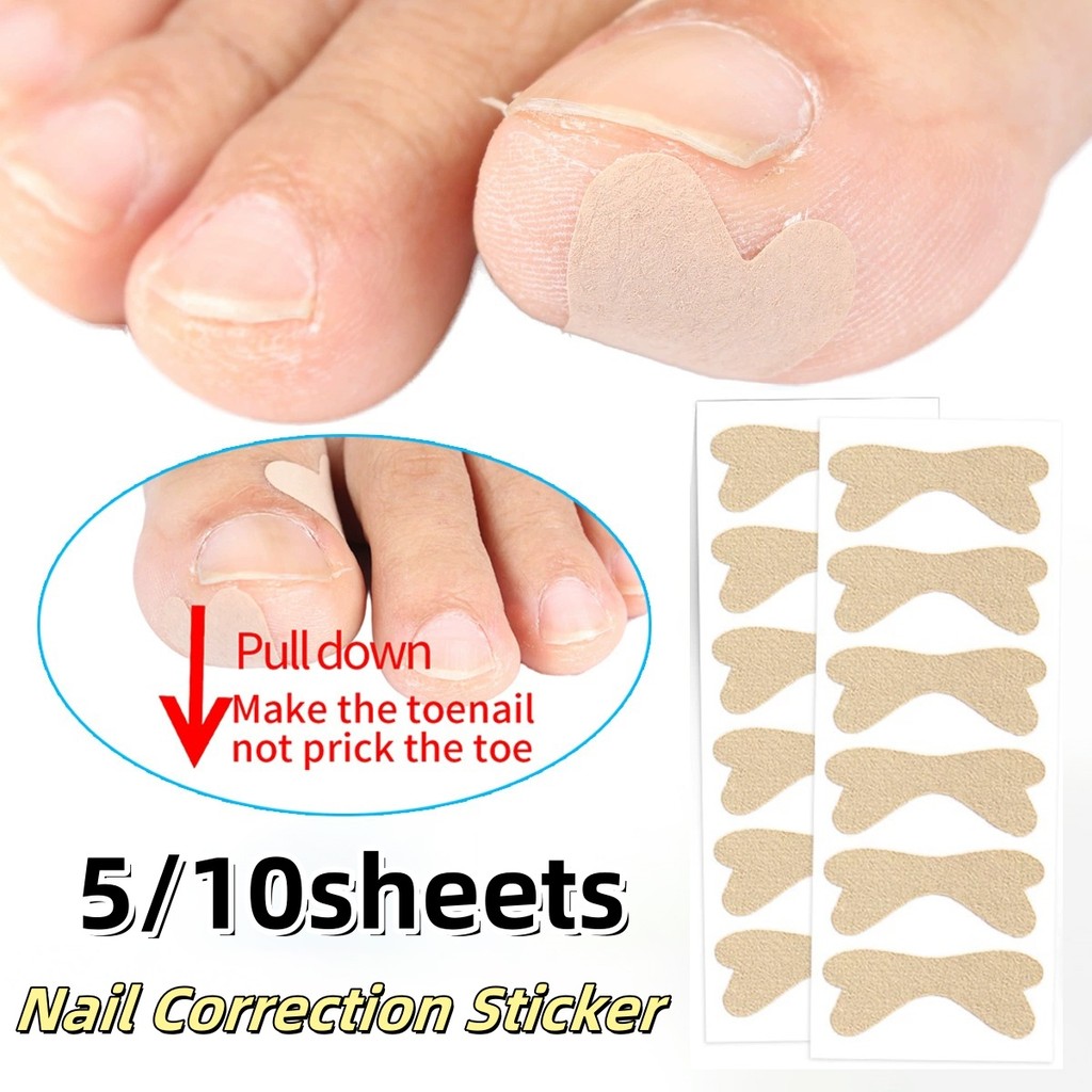 5/10Sheets Ingrown Nail Correction Stickers Corrector Paronychia ...
