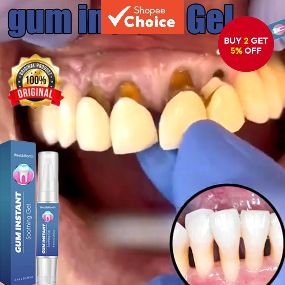 Gum Instant Soothing Gel Receding Gums Therapy Inflammation Treatment ...