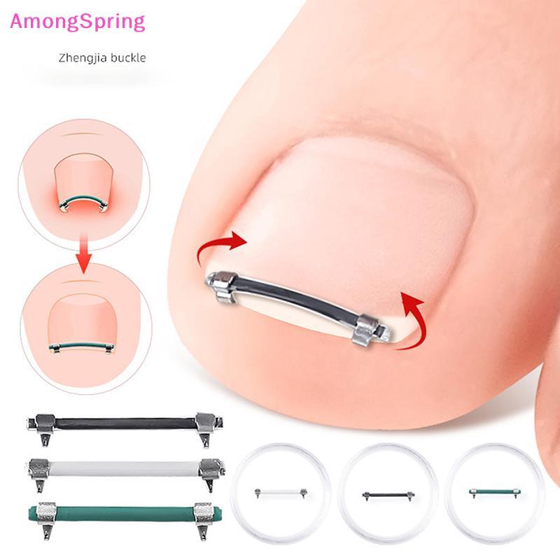 AmongSpring Ingrown Toenail Pedicure Tool Embed Toe Nail Care ...