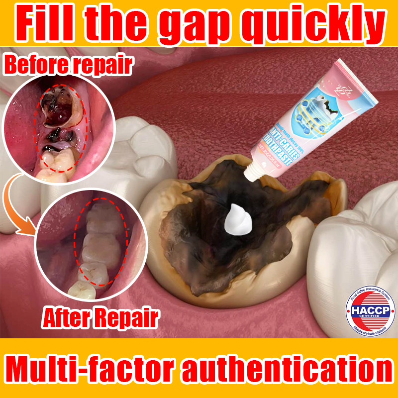 【Japanese Technology】Anti-cavity toothpaste, whitening toothpaste ...
