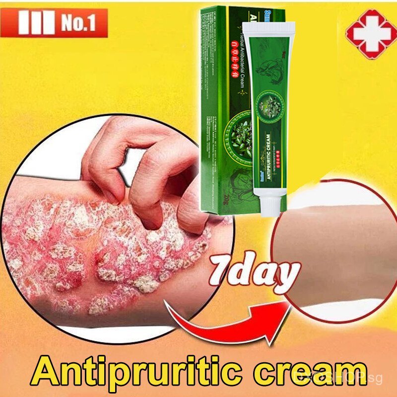 Antipruritic cream Repair eczema itch Fast itching relief cream 20g ...