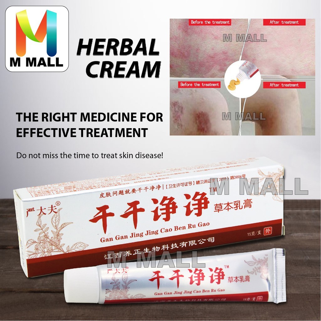 15g Herbal Cream Natural Chinese Formula for Skin Eczema, Dermatitis ...