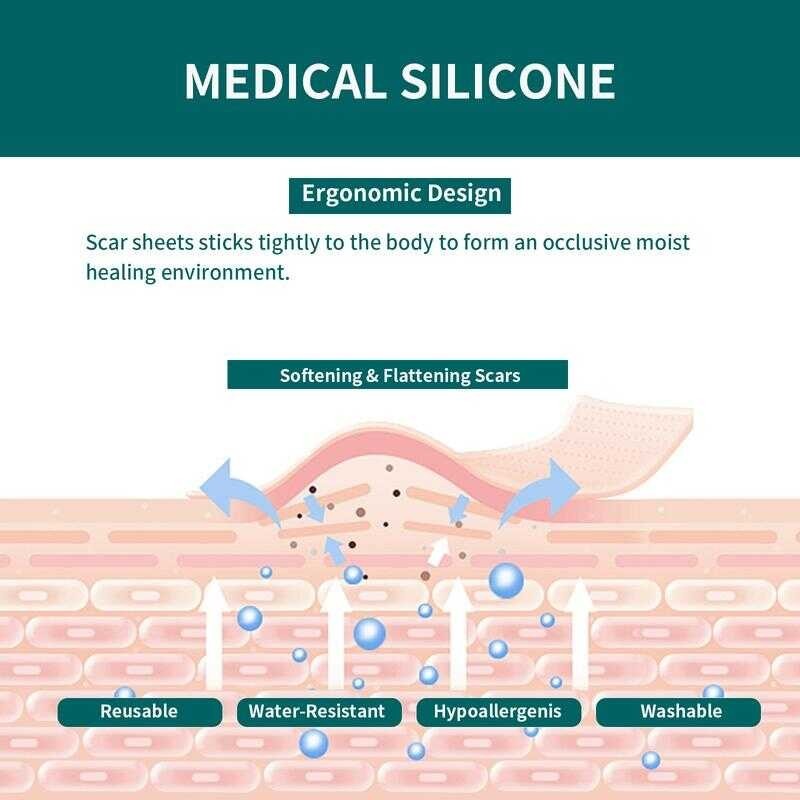 Product image Buy 1 Get 3 QUSTERE Silicone Scar Tape Gel Strips 2M (1.6" X 60" Roll) Professional Removal Patches Sheet Gentle 3