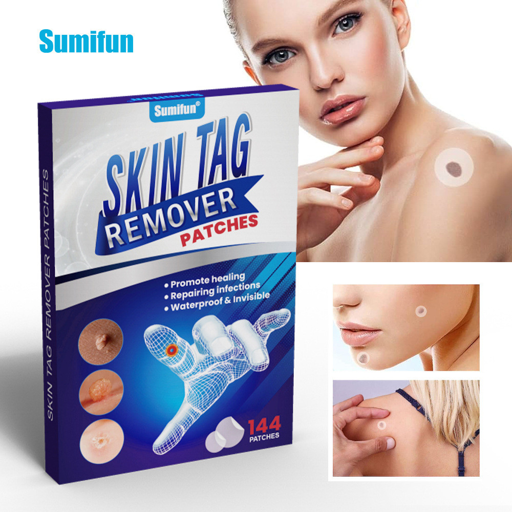 Sumifun Gram Warts Skin Moles Cleansing Care Remove Corns Fleshy Warts ...