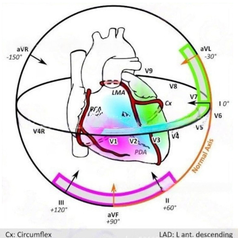 [Qwy] EKG Poet Guide, EKG Rhythm Interpretation, Double Sidedpact ...