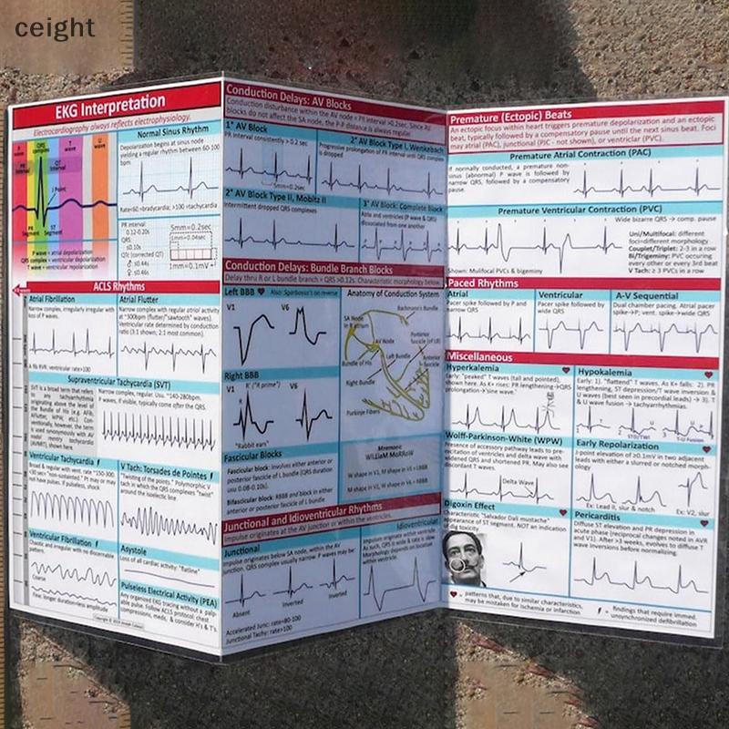[ceight] EKG Poet Guide, EKG Rhythm Interpretation, Double Sidedpact ...