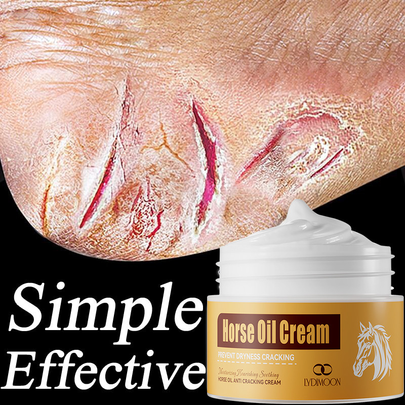 Horse Oil Cracked Heel Cream Foot Cream Repair Dry Heels Cracked Hands ...