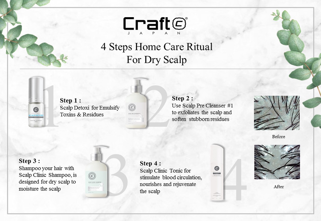 Craft Scalp Clinic Shampoo 300ml 1000ml ( For Energizing & Thinning ...