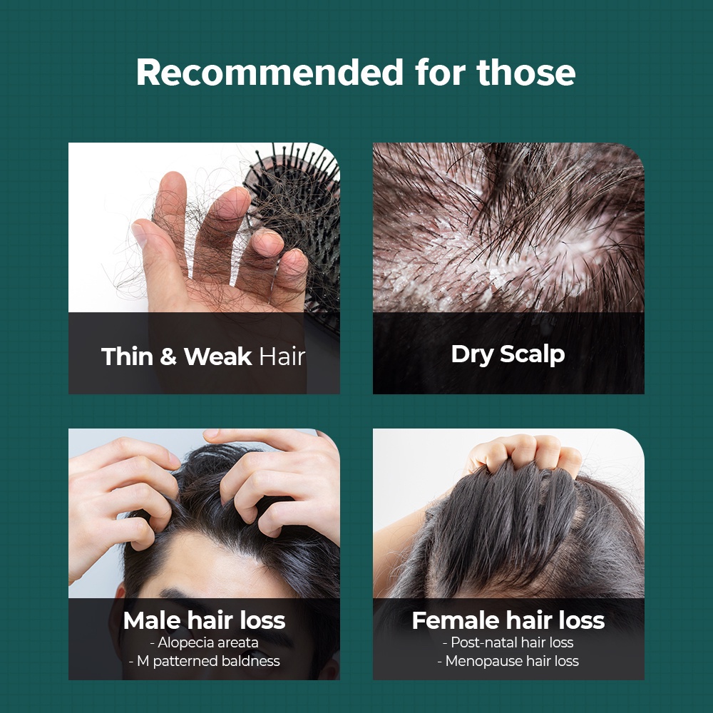 Shopee x [GRAFEN] Mega Beauty Box Root Booster Shampoo 500 x2 [Anti