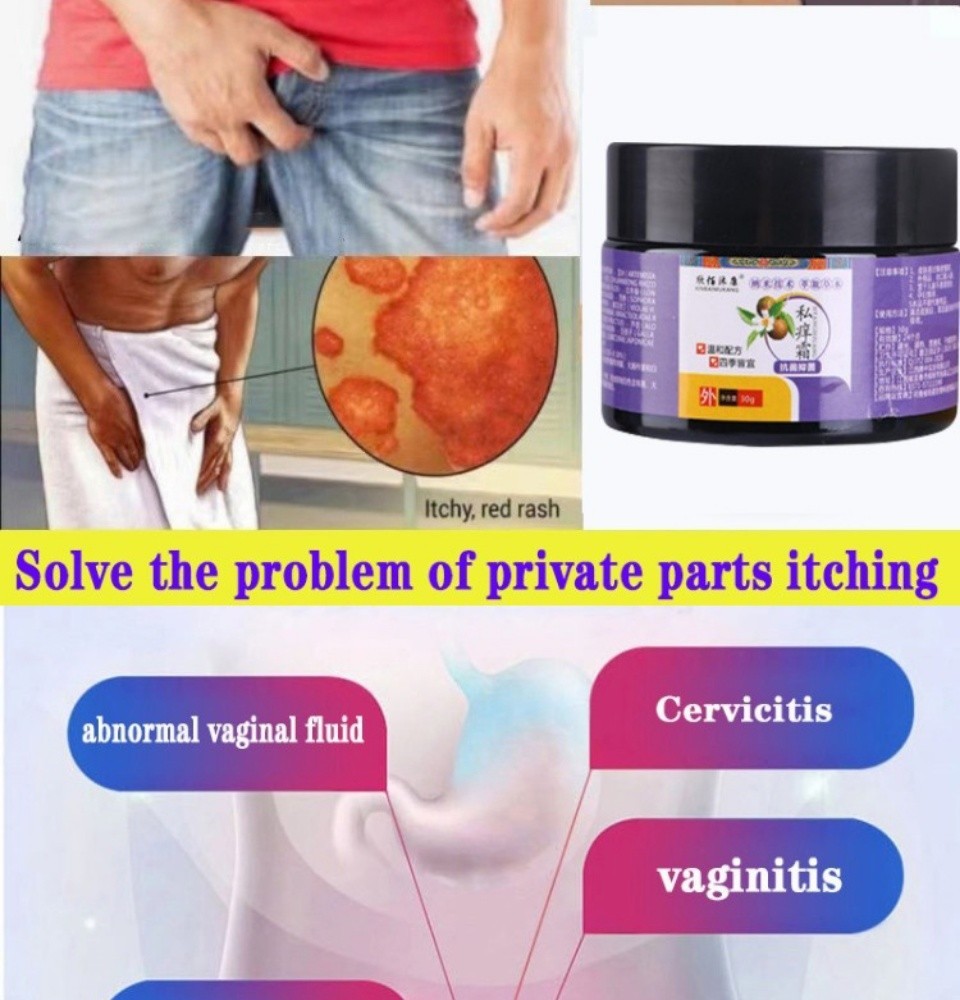 Y12 Anti-itch cream Fast relief 30g man skin care cream antibacterial ...