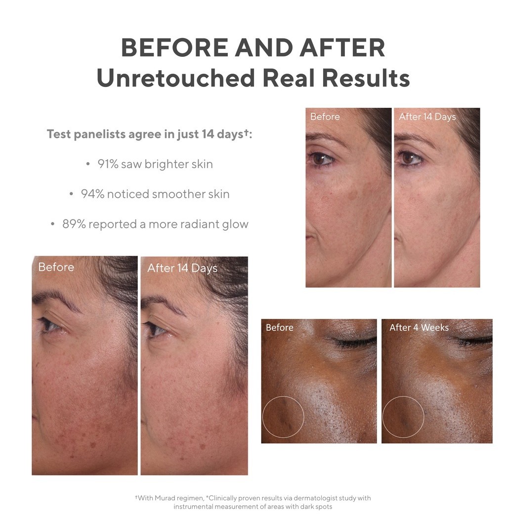 Murad Rapid Dark Spot Correcting Serum | Shopee Singapore