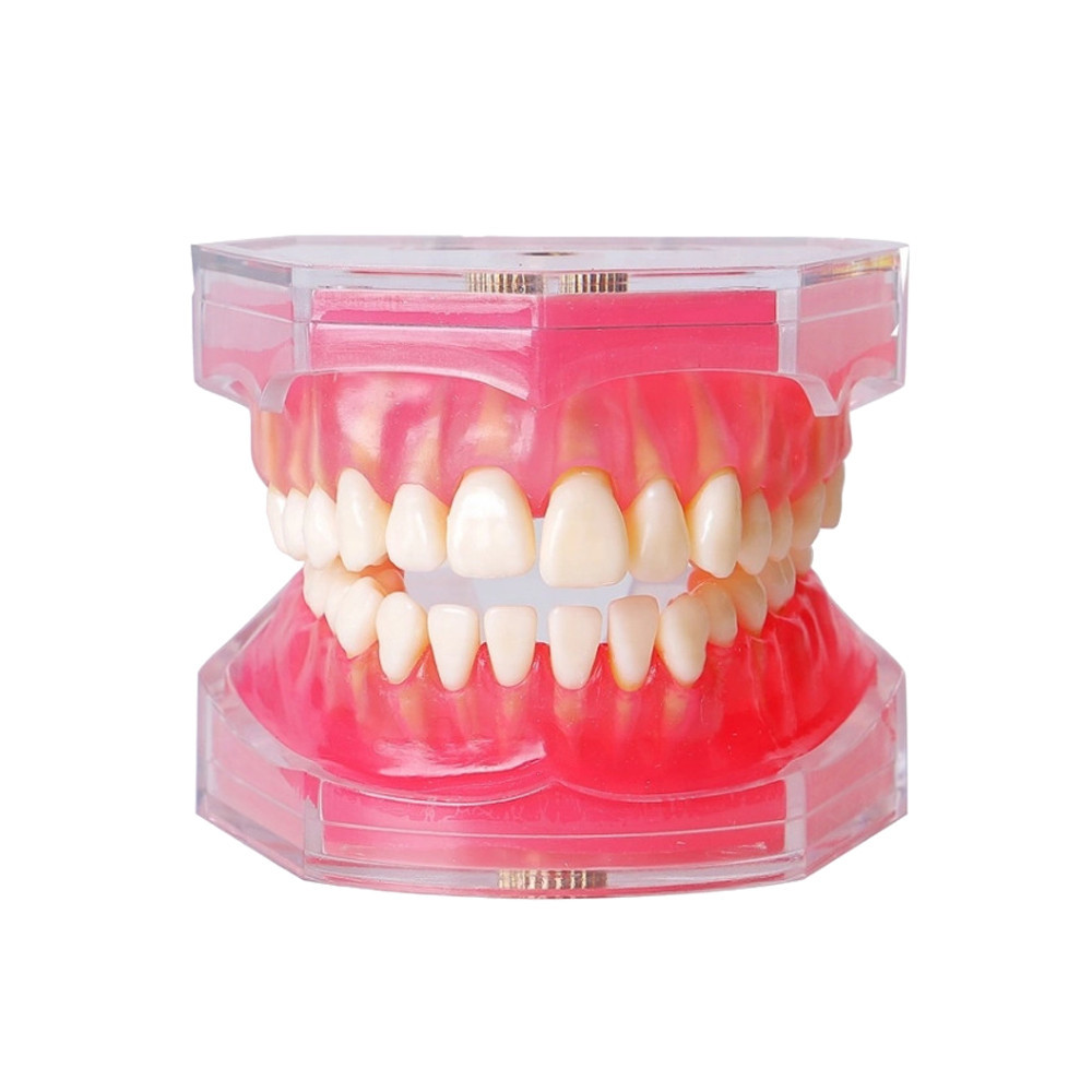 Dental Model With Removable Teeth Jaw Typodont Soft Gum Adult Standard ...