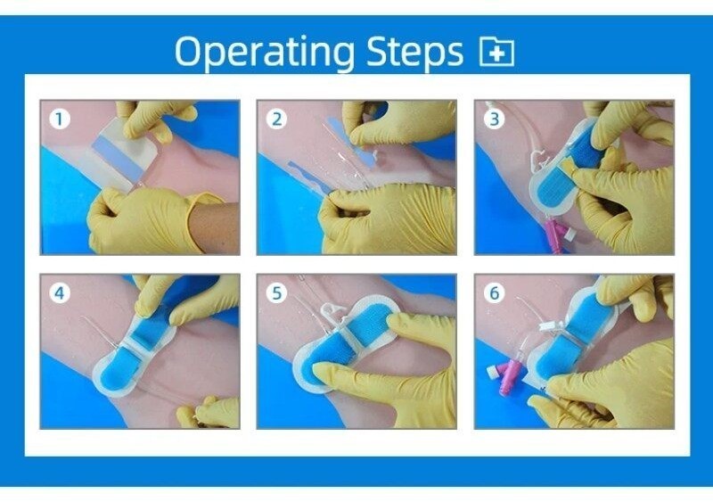 Drainage tube holder Urinary catheter stent Legband Fixation Stickers ...