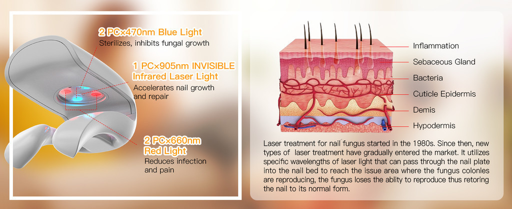 KTS Nail Fungus Laser Device 6 colors Foot Care Devices Fungal Nail ...
