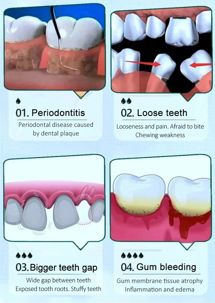 【Hot sale】[No need to pull out loose teeth]