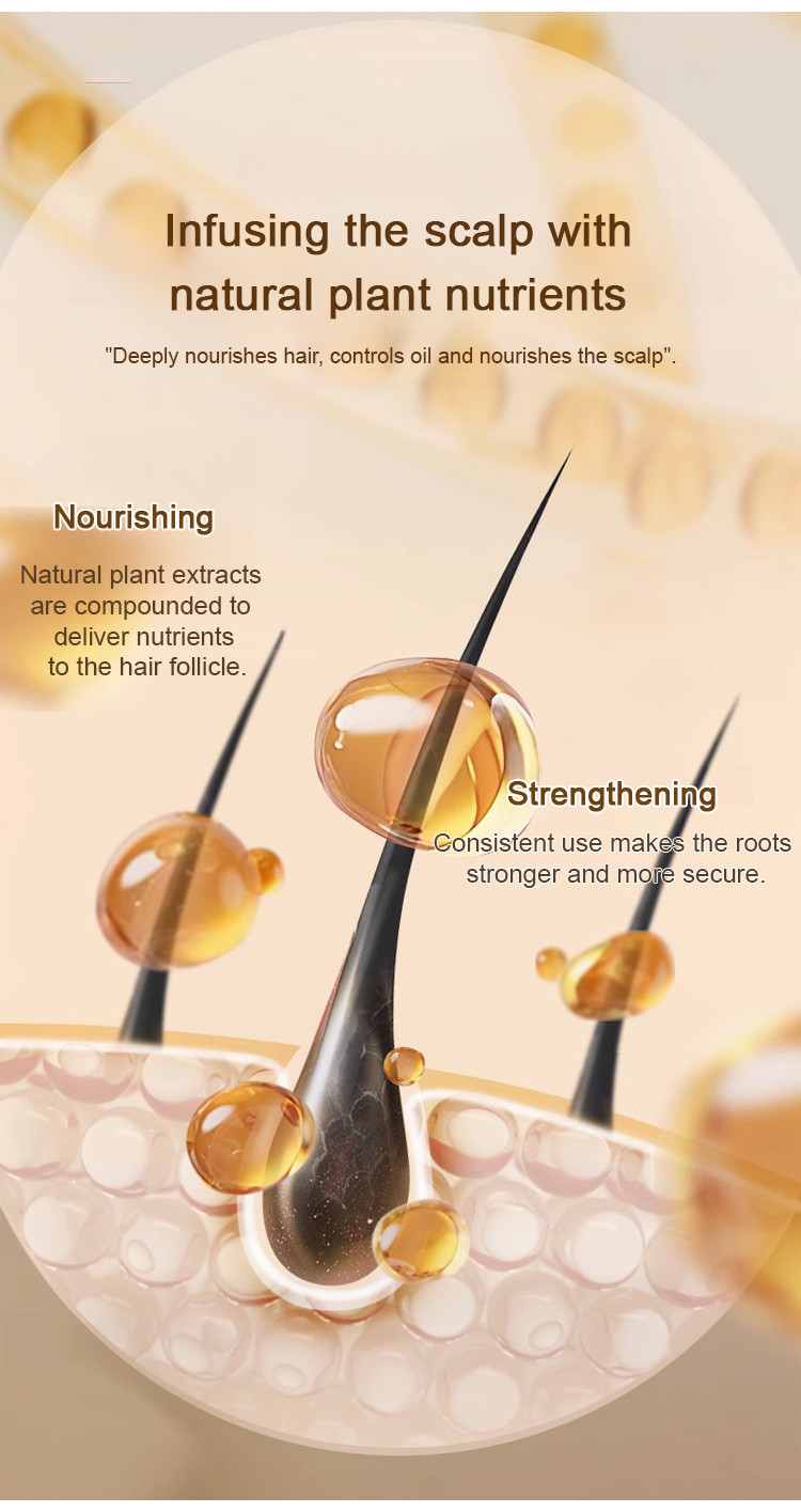【Hot sale】[Strong hair roots]官方正品 Ginger Plant Extract Anti-Hair Loss ...