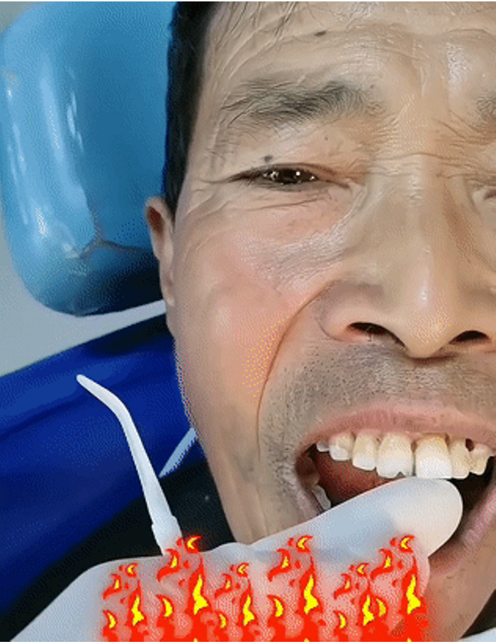 【Hot sale】[No need to pull out loose teeth]