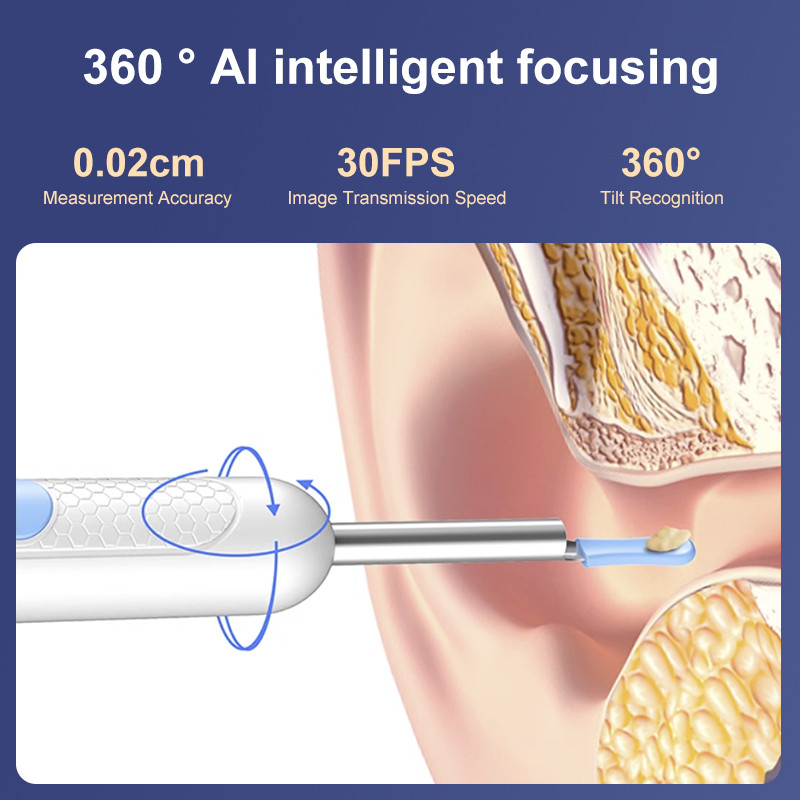SG Earpick Smart Visual Ear Picker 15-in-1 With Camera For Baby Adult ...