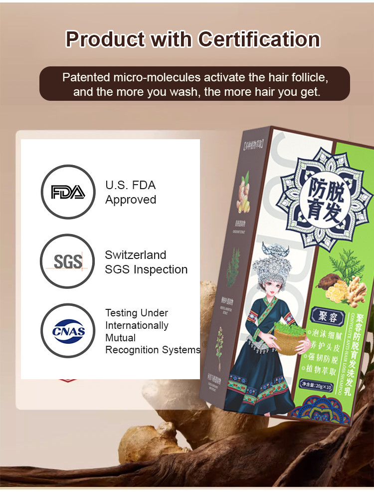 【Hot sale】[Strong hair roots]官方正品 Ginger Plant Extract Anti-Hair Loss ...