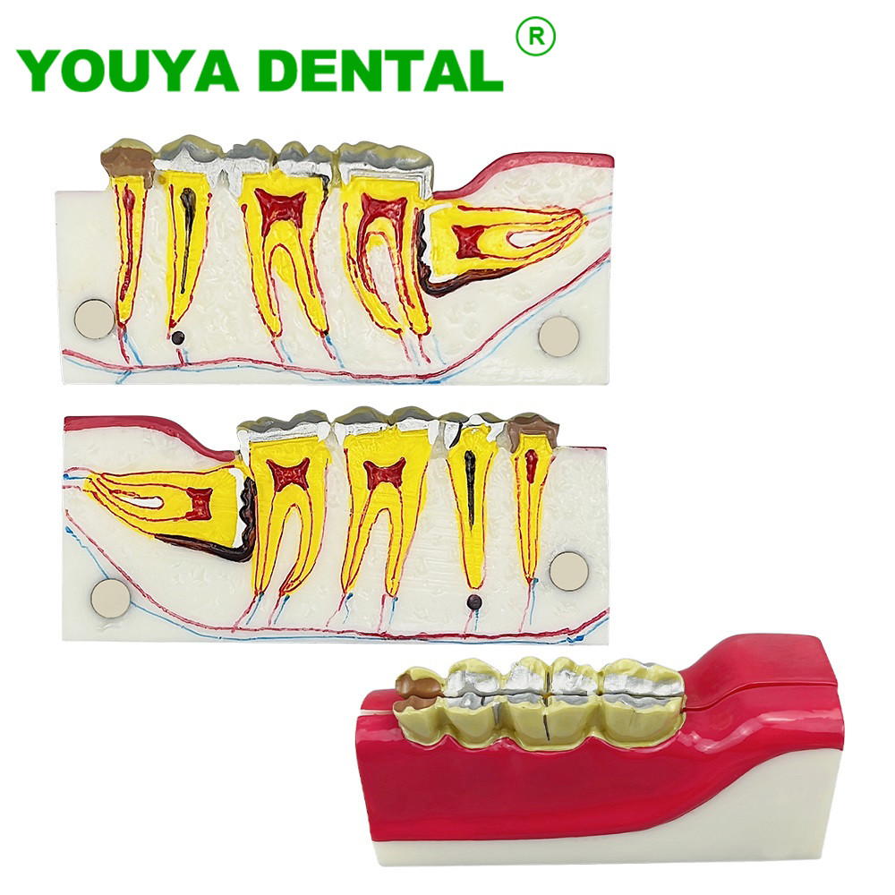 Dental Teeth Anatomical Right Posterior Tooth Cross Section ...