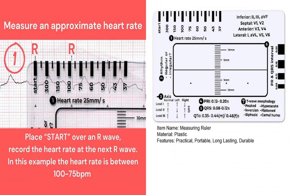 Producto: ECG 7 Step Ruler, ECG 7 Step Ruler For ECG/EKG Interpretation, ECG Ruler, Follow A 7 Step Plan, Transparent EKG Calipers Measuring Tool, Portable ECG Assessment Tool EKG Card