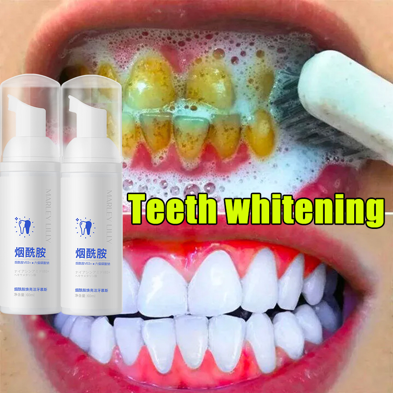 Tooth Mousse Tooth Whitening Oral Hygiene Toothpaste Remove Stains Yellow Teeth Fresh Breath