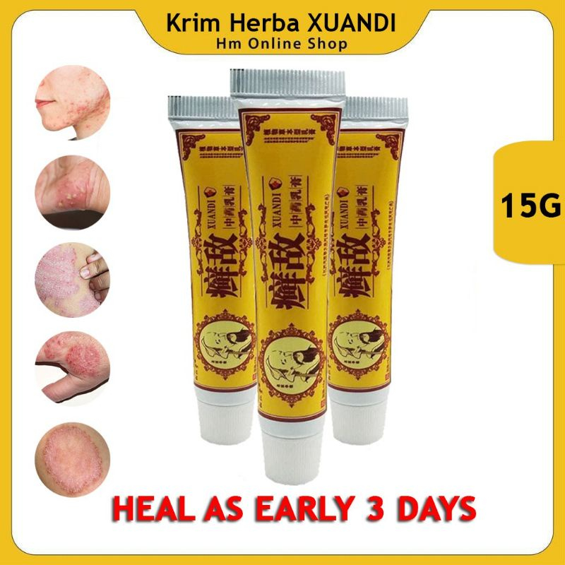 XUANDI Psoriasis Eczema Antifungal Antibacterial Itchy Cream Herbal ...