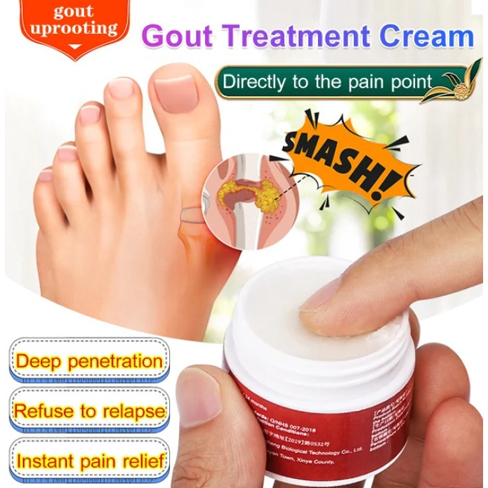 Sumifun Gout Treatment Ointment Joint Hallux Valgus Pain Relief ...