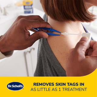 Dr. Scholl's Freeze Away Skin Tag Remover (8 Treatments) | Shopee Singapore