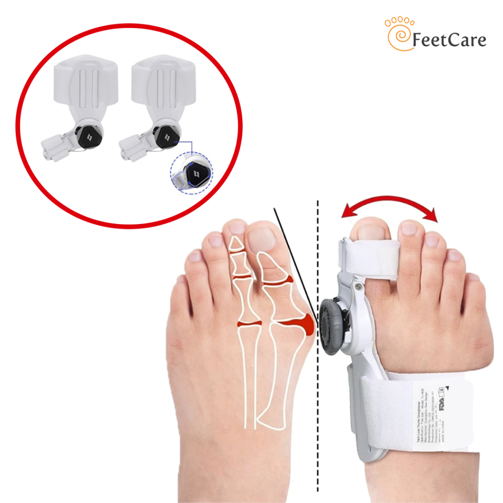 [1pair] Adjustable Hallux Valgus Splint Bunion Corrector Bunion