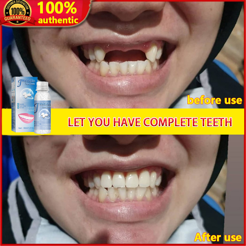 Denture Adhesive Cream Teeth Gaps Missing Broken Tooth False Teeth