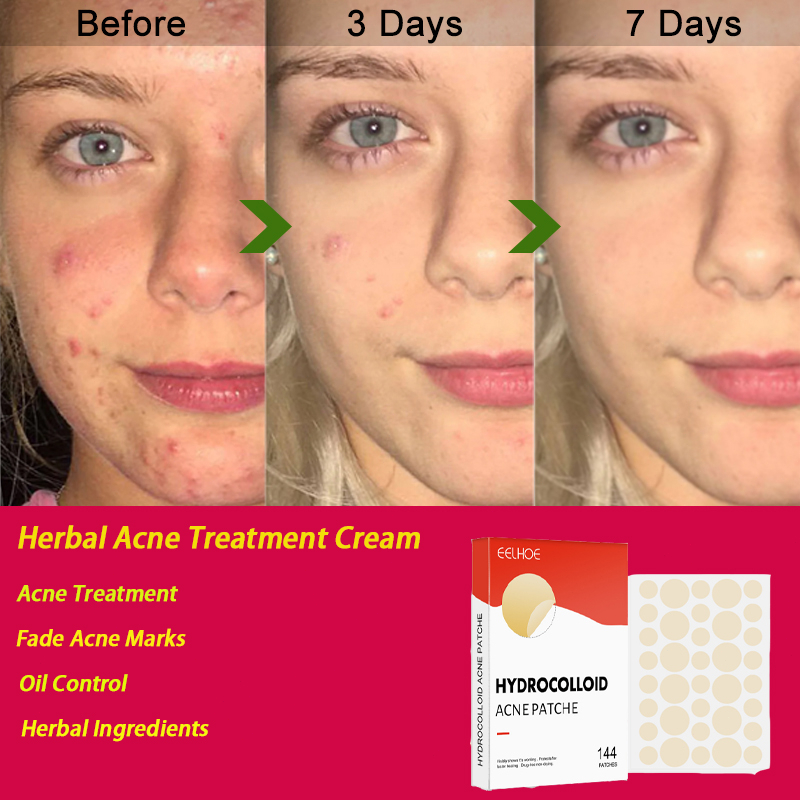 Pimple Patch Mighty Pimple Healing Patches Hydrocolloid Acnes Pimple Patch For Zits Blemishes