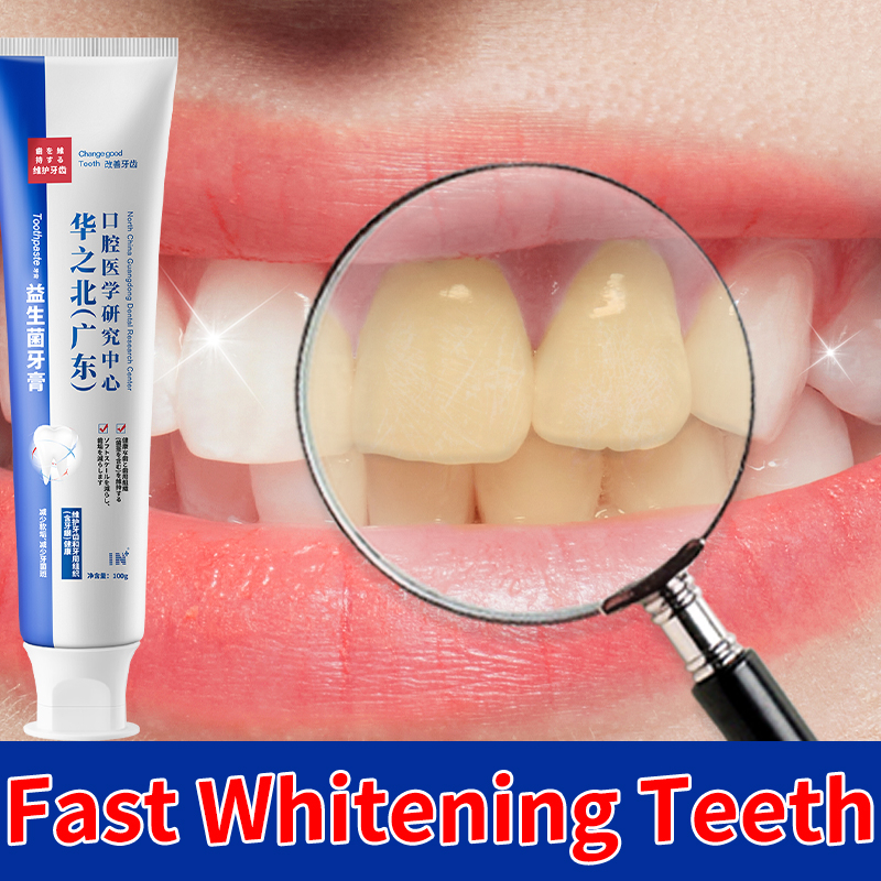 Teeth Whitening Toothpaste Remove Tartar Yellow Teeth Removal Smoking ...