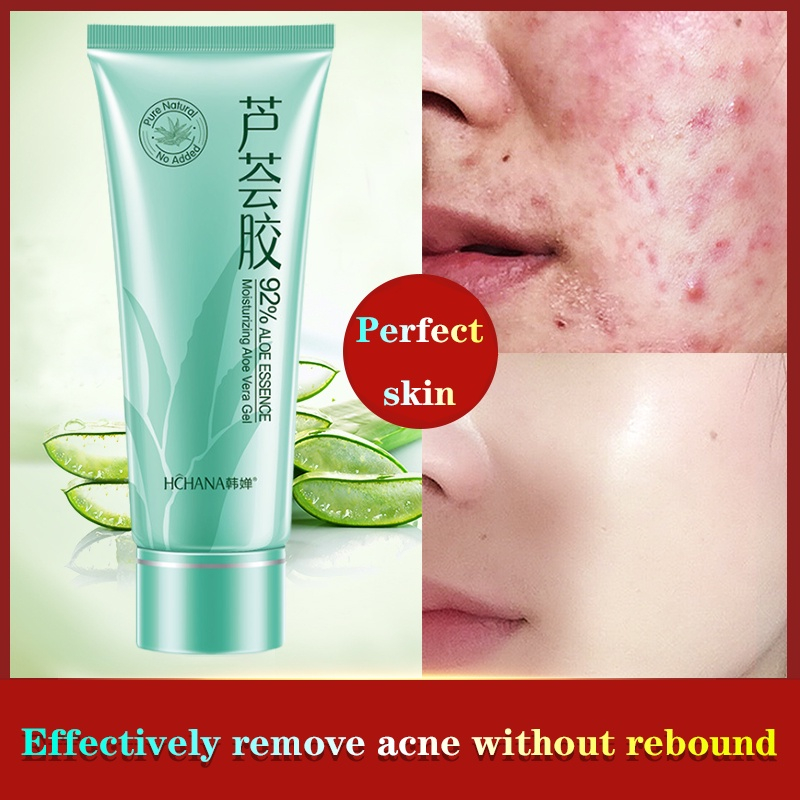 Aloe Vera 92 Soothing & Moisture Gel 40g Acne Removing Acne Scar Removal Blackhead Removal