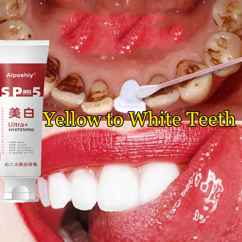 【3day teeth whitening】Teeth Whitening Toothpaste Removing Yellow Teeth