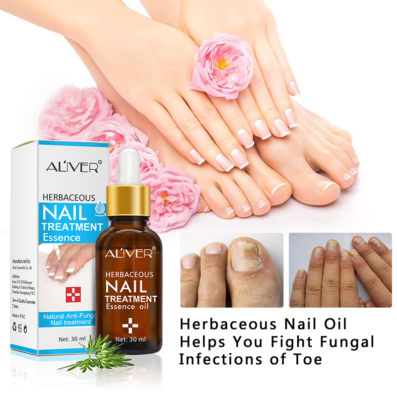 ALIVER 30ml Herbaceous Nail Treatment Essence Natural Anti-Fungal Nail ...