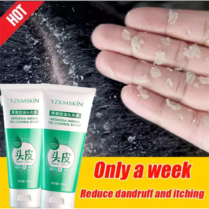Dandruff Shampoo For Oily Scalp Oil Control Cleaning Dandruff Antipruritic Shampoo To Prevent
