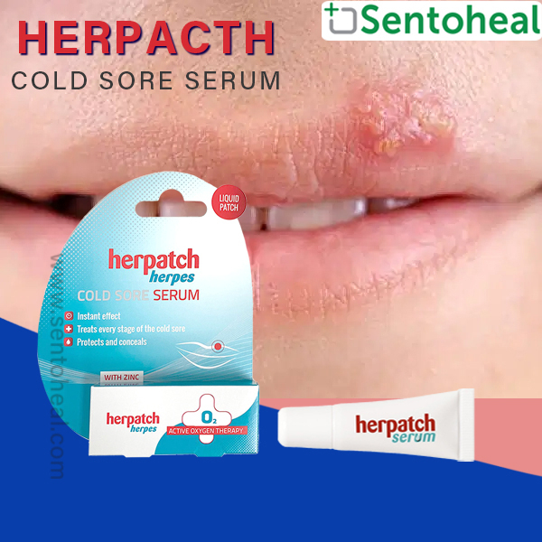 Herpatch Herpes Cold Sore Serum 5ml Liquid patch Shopee Singapore