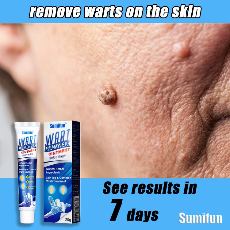 Skin Tag Remover Against Mole & Genital Wart Fast Anti Foot Corn
