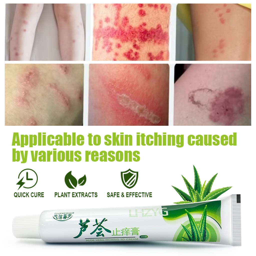 [Sg STOCK]Eczema dermatitis cream beriberi Inhibit Skin Fungus Anti