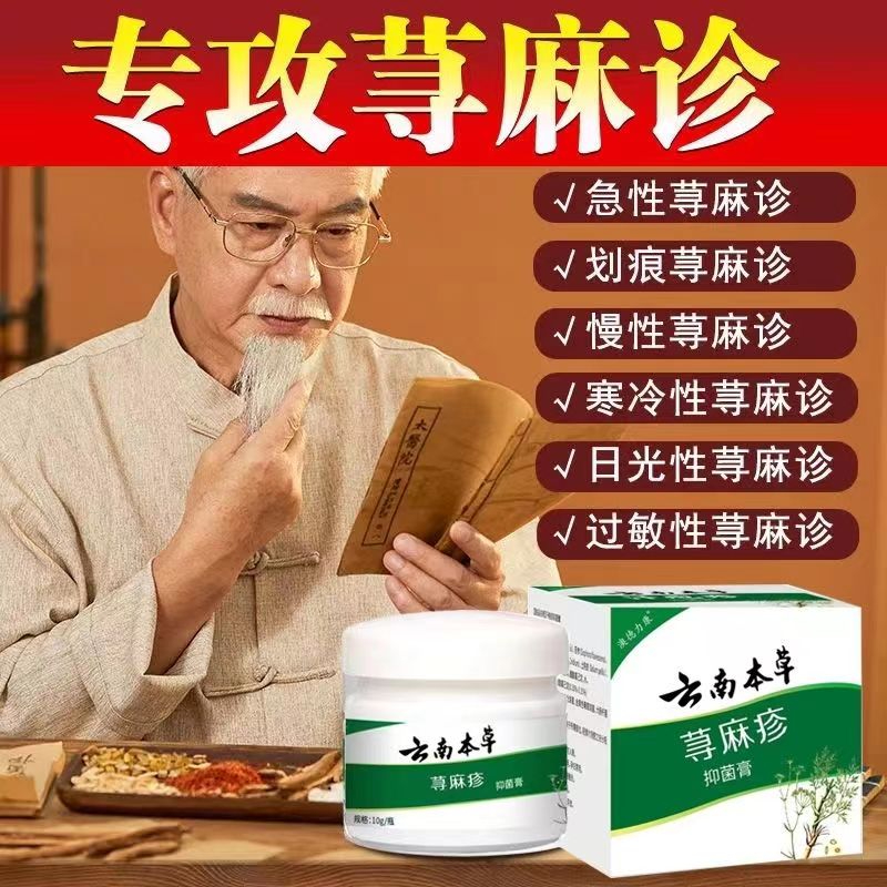 Herpes perspiration long blisters on hands and feet itching blister