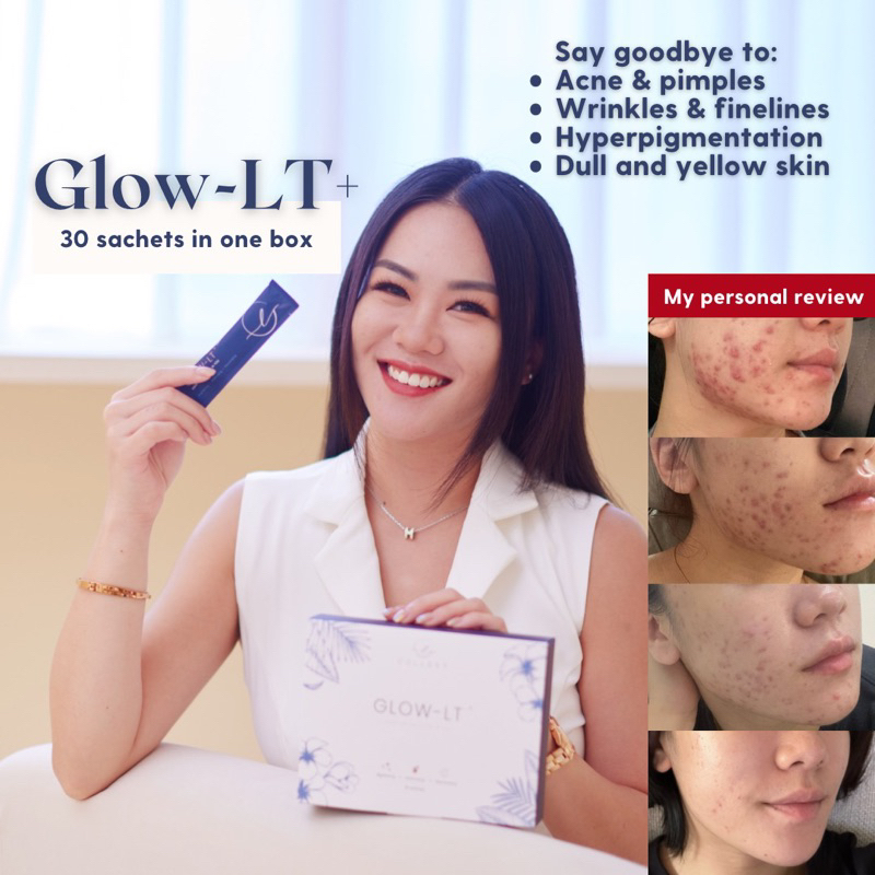 [?6.6 PROMO - 4 boxes free tumblr] COLLEET Glow-LT+ ?Her World Beauty Awards Best Oral Beauty Supplement | GlowWithGrace
