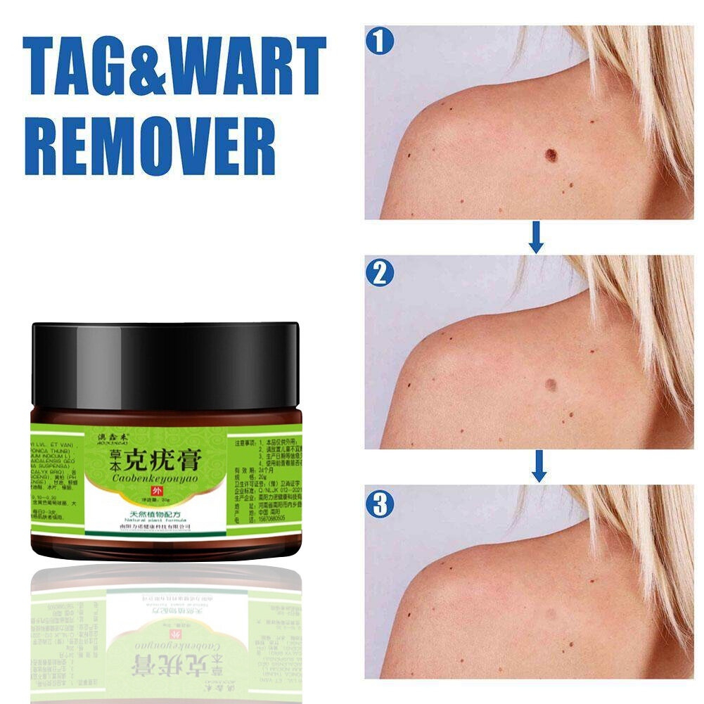 Warts Remover Original Cream Wart Removal Ointment Wart Treatment Skin